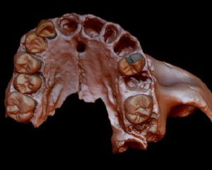Вчені порівняли ДНК із зубів людини-попередника та людини прямоходячої Фото: livescience.com