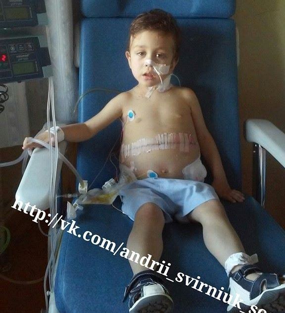Андрійко Свірнюк, якому успішно провели трансплантацію печінки, почуває себе добре