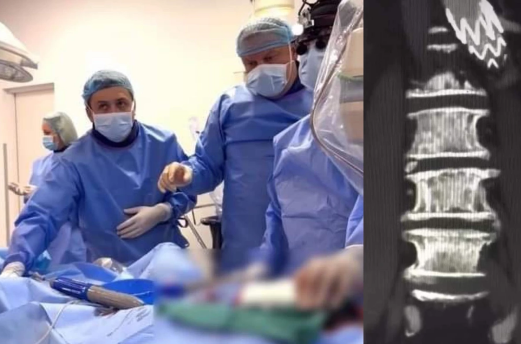 У Львівській обласній клінічній лікарні пацієнту імплантували біфуркаційний протез