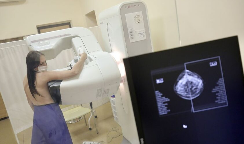 Жінок Львівської громади запрошують пройти мамографію